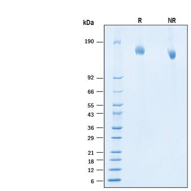 2 μg/lane of Biotinylated Recombinant SARS-CoVC.37 Spike (GCN4-IZ) Avi-tag His-tag Protein (Catalog # AVI10887) was resolved with SDS-PAGE under reducing (R) and non-reducing (NR) conditions and visualized by Coomassie® Blue staining, showing bands at 145-170 kDa.