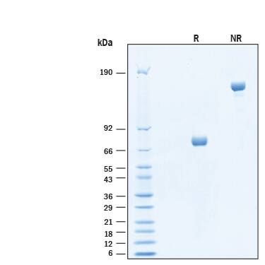 2 μg/lane of Biotinylated Recombinant Human CD38 Fc Chimera Avi-tag Protein (Catalog # AVI10920) was resolved with SDS-PAGE under reducing (R) and non-reducing (NR) conditions and visualized by Coomassie® Blue staining, showing bands at 69-77 kDa and 140-150 kDa, respectively.