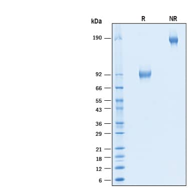 SDS-Page CEACAM6/CD66c [Biotin]