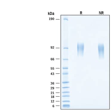 SDS-Page CD117/c-kit [Biotin]