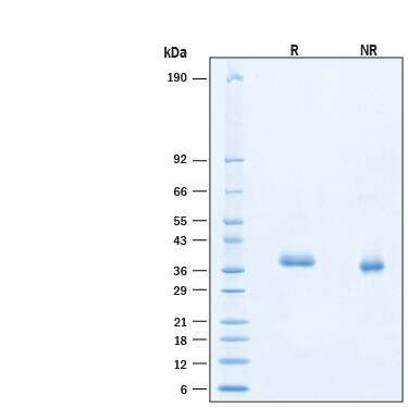 2 μg/lane of Biotinylated Recombinant SARS-CoV-2 B.1.617.2 (G446V) Spike RBD His-tag Avi-tag Protein (Catalog # AVI10982) was resolved with SDS-PAGE under reducing (R) and non-reducing (NR) conditions and visualized by Coomassie® Blue staining, showing bands at 34-41 kDa.