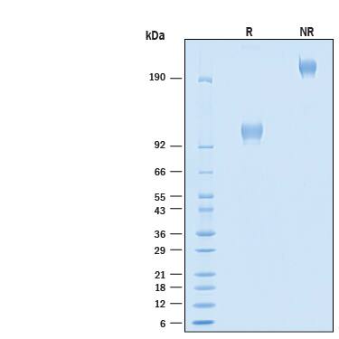 2 μg/lane of Biotinylated Recombinant Human Axl Fc Chimera Avi-tag Protein (Catalog # AVI11011) was resolved with SDS-PAGE under reducing (R) and non-reducing (NR) conditions and visualized by Coomassie® Blue staining, showing bands at 89-115 kDa and 180-230 kDa, respectively.