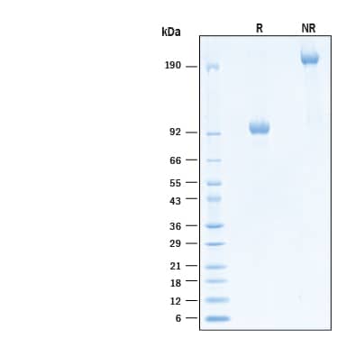 2 μg/lane of Biotinylated Recombinant Human FGFR3 (IIIb) Fc Chimera Avi-tag Protein (Catalog # AVI11029) was resolved with SDS-PAGE under reducing (R) and non-reducing (NR) conditions and visualized by Coomassie® Blue staining, showing bands at 92-104 kDa and 184-208 kDa, respectively.