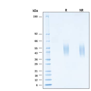 2 μg/lane of Biotinylated Recombinant Human IFN‑ gamma  R1/CD119 Avi-tag His-tag Protein (Catalog # AVI11030) was resolved with SDS-PAGE under reducing (R) and non-reducing (NR) conditions and visualized by Coomassie® Blue staining, showing bands at 42‑55 kDa.