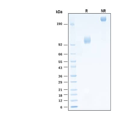 2 μg/lane of Biotinylated Recombinant Human FGFR1 alpha (IIIc) Fc Chimera Avi-tag Protein (Catalog # AVI11031) was resolved with SDS-PAGE under reducing (R) and non-reducing (NR) conditions and visualized by Coomassie® Blue staining, showing bands at 100-120 kDa and 200-240 kDa, respectively.