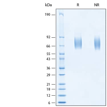 2 μg/lane of Recombinant Human FGFR2 alpha (IIIc) His Avi-tag Protein (Catalog # AVI11119) was resolved with SDS-PAGE under reducing (R) and non-reducing (NR) conditions and visualized by Coomassie® Blue staining, showing bands at 68-78 kDa.