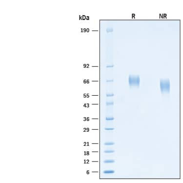 2 μg/lane of Biotinylated Recombinant Human FGFR4 His-tag Avi-tag Protein (Catalog # AVI11120) was resolved with SDS-PAGE under reducing (R) and non-reducing (NR) conditions and visualized by Coomassie® Blue staining, showing bands at 60-75 kDa.