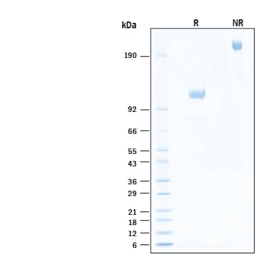 2 μg/lane of Biotinylated Recombinant Human CD6 Fc Chimera Avi-tag Protein (Catalog # AVI11123) was resolved with SDS-PAGE under reducing (R) and non-reducing (NR) conditions and visualized by Coomassie® Blue staining, showing bands at 105-118 kDa and 210-240 kDa, respectively.