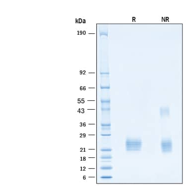 SDS-Page TIGIT [Biotin]