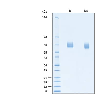 2 μg/lane of Biotinylated Recombinant Human FGFR3 (IIIb) His-tag Avi-tag Protein (Catalog # AVI11136) was resolved with SDS-PAGE under reducing (R) and non-reducing (NR) conditions and visualized by Coomassie® Blue staining, showing bands at 55-75 kDa.