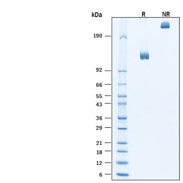 2 μg/lane of Biotinylated Recombinant Human DPPIV/CD26 Fc Chimera Avi-tag Protein (Catalog # AVI11141) was resolved with SDS-PAGE under reducing (R) and non-reducing (NR) conditions and visualized by Coomassie® Blue staining, showing a band at ~123 kDa under reducing conditions.