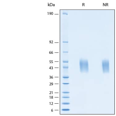 2 μg/lane of Recombinant Human IL-4R alpha His-tag Avi-tag Protein (Catalog # AVI11165) was resolved with SDS-PAGE under reducing (R) and non-reducing (NR) conditions and visualized by Coomassie® Blue staining, showing bands at 39-52 kDa.