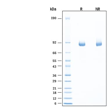 2 μg/lane of Biotinylated Recombinant Human  alpha ‑L‑Iduronidase/IDUA His-tag Avi-tag Protein (Catalog # AVI11180) was resolved with SDS-PAGE under reducing (R) and non-reducing (NR) conditions and visualized by Coomassie® Blue staining, showing bands at 81-91 kDa, under reducing conditions.