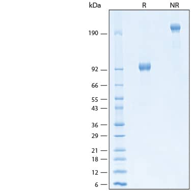 2 μg/lane of Recombinant Human IL-6R alpha Fc Chimera Avi-tag Protein (Catalog # AVI11257) was resolved with SDS-PAGE under reducing (R) and non-reducing (NR) conditions and visualized by Coomassie® Blue staining, showing bands at 90-105 kDa and 180-210 kDa, respectively.