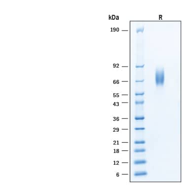 2 μg/lane of Biotinylated Recombinant Human ST2/IL-33R Avi-tag His-tag Protein (Catalog # AVI11272) was resolved with SDS-PAGE under reducing (R) condition and visualized by Coomassie® Blue staining, showing bands at 60-110 kDa.