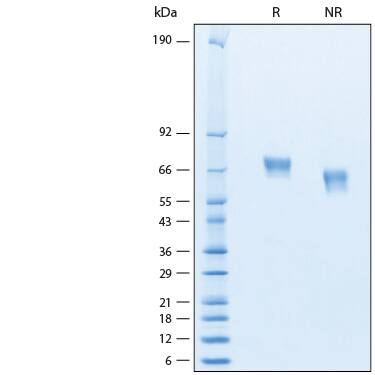 2 μg/lane of Recombinant Human MAdCAM-1 His-tag Avi-tag Protein (Catalog # AVI11276) was resolved with SDS-PAGE under reducing (R) and non-reducing (NR) conditions and visualized by Coomassie® Blue staining, showing bands at 65-75 kDa.