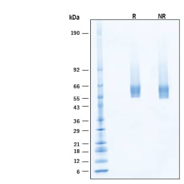 2 μg/lane of Biotinylated Recombinant Human IL‑5 R alpha /CD125 Avi-tag His-tag Protein (Catalog # AVI11394) was resolved with SDS-PAGE under reducing (R) and non-reducing (NR) conditions and visualized by Coomassie® Blue staining, showing bands at 52-63 kDa, under reducing conditions.