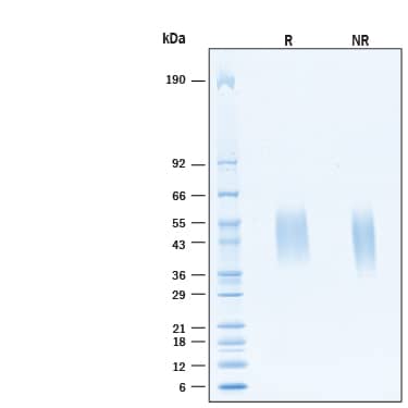 2 μg/lane of Biotinylated Recombinant Human CRACC/SLAMF7 His-tag Protein (Catalog # AVI11533) was resolved with SDS-PAGE under reducing (R) and non-reducing (NR) conditions and visualized by Coomassie® Blue staining, showing bands at 44-52 kDa, under reducing conditions.