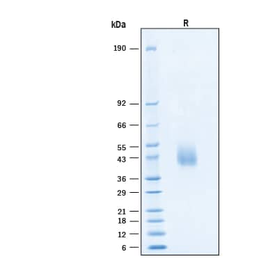 2 μg/lane of Recombinant Human IFN-gamma R2 His-tag Avi-tag Protein (Catalog # AVI11576) was resolved with SDS-PAGE under reducing (R) condition and visualized by Coomassie® Blue staining, showing bands at 40‑44 kDa.