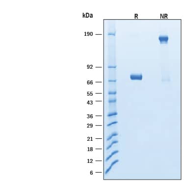 2 μg/lane of Biotinylated Recombinant Human IFN-gamma R2 Fc Chimera Avi-tag Protein (Catalog # AVI11578) was resolved with SDS-PAGE under reducing (R) and non-reducing (NR) conditions and visualized by Coomassie® Blue staining, showing bands at 67-74 kDa and 130-150 kDa, respectively.