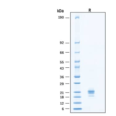 2 μg/lane of Biotinylated Recombinant Human CD40 Ligand/TNFSF5 Avi-tag His-tag Protein (Catalog # AVI11596) was resolved with SDS-PAGE under reducing (R) condition and visualized by Coomassie® Blue staining, showing bands at 18-25 kDa.