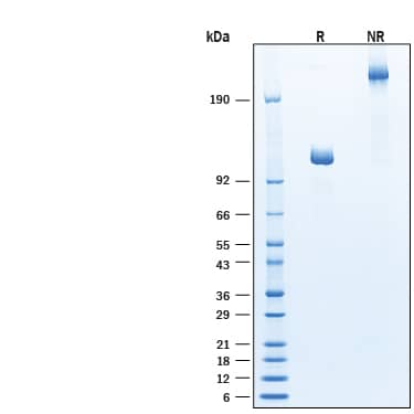 2 μg/lane of Biotinylated Recombinant Human alpha‑L‑Iduronidase/IDUA Fc Chimera Avi-tag Protein (Catalog # AVI11613) was resolved with SDS-PAGE under reducing (R) and non-reducing (NR) conditions and visualized by Coomassie® Blue staining, showing bands at 104-115 kDa and 210-230 kDa, respectively.