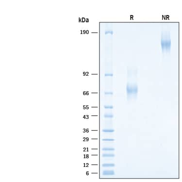 2 μg/lane of Biotinylated Recombinant Human IL‑18 BPa Fc Chimera Avi-tag Protein (Catalog # AVI119) was resolved with SDS-PAGE under reducing (R) and non-reducing (NR) conditions and visualized by Coomassie® Blue staining, showing bands at 65 - 76 kDa & 91-101 kDa and 130-155 kDa & 180 - 200 kDa respectively.