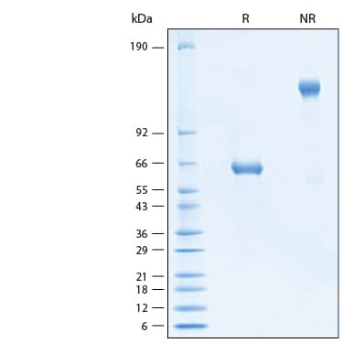 SDS-Page ULBP-2 [Biotin]