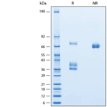 2 μg/lane of Recombinant Human MSPR/Ron His-tag Avi-tag Protein (Catalog # AVI1947) was resolved with SDS-PAGE under reducing (R) and non-reducing (NR) conditions and visualized by Coomassie® Blue staining, showing bands at 34-42 and 64-78 kDa.