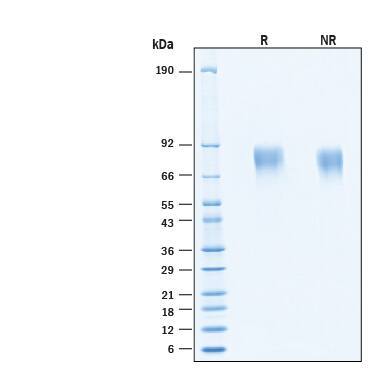 SDS-Page GUCY2C [Biotin]