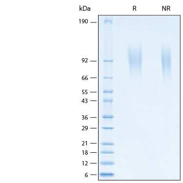 2 μg/lane of Recombinant Human CEACAM-1/CD66a His-tag Avi-tag Protein (Catalog # AVI2244) was resolved with SDS-PAGE under reducing (R) and non-reducing (NR) conditions and visualized by Coomassie® Blue staining, showing bands at 85-105 kDa.