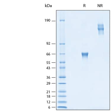 2 μg/lane of Recombinant Human NKp44/NCR2 Fc Chimera Avi-tag Protein (Catalog # AVI2249) was resolved with SDS-PAGE under reducing (R) and non-reducing (NR) conditions and visualized by Coomassie® Blue staining, showing bands at 60-70 kDa and 120-150 kDa, respectively.