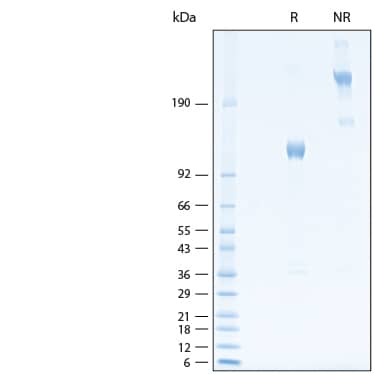 2 μg/lane of Recombinant Human Osteoactivin/GPNMB Fc Chimera Avi-tag Protein (Catalog # AVI2550) was resolved with SDS-PAGE under reducing (R) and non-reducing (NR) conditions and visualized by Coomassie® Blue staining, showing bands at 110-126 kDa and 220-250 kDa, respectively.