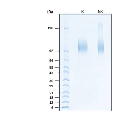 2 μg/lane of Recombinant Human IL-31RA Avi-tag His-tag Protein (Catalog # AVI2769) was resolved with SDS-PAGE under reducing (R) and non-reducing (NR) conditions and visualized by Coomassie® Blue staining, showing bands at 90-105 kDa, under reducing conditions..