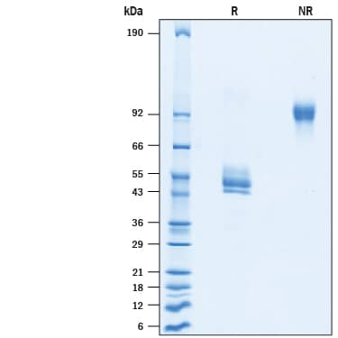 SDS-Page TGF-beta RI/ALK-5 [Biotin]