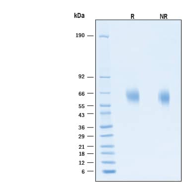 2 μg/lane of Biotinylated Recombinant Human Common gamma Chain Avi-tag His-tag Protein (Catalog # AVI384) was resolved with SDS-PAGE under reducing (R) and non-reducing (NR) conditions and visualized by Coomassie® Blue staining, showing bands at 60‑67 kDa, under reducing conditions.