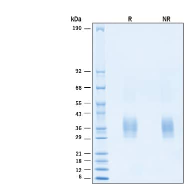 2 μg/lane of Biotinylated Recombinant Human TRANCE/TNFSF11/RANK L His-tag Avi-tag Protein (Catalog # AVI390) was resolved with SDS-PAGE under reducing (R) and non-reducing (NR) conditions and visualized by Coomassie® Blue staining, showing bands at 26-39 kDa.