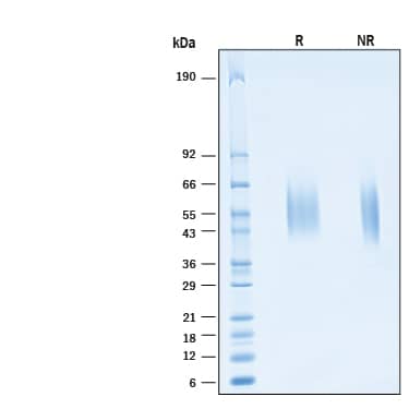 2 μg/lane of Biotinylated Recombinant Human Fc epsilon  RI alpha  Avi-tag His-tag Protein (Catalog # AVI6678) was resolved with SDS-PAGE under reducing (R) and non-reducing (NR) conditions and visualized by Coomassie® Blue staining, showing bands at 50-60 kDa.