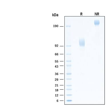 2 μg/lane of Biotinylated Recombinant Human FGFR2 alpha (IIIc) Fc Chimera Avi-tag Protein (Catalog # AVI712) was resolved with SDS-PAGE under reducing (R) and non-reducing (NR) conditions and visualized by Coomassie® Blue staining, showing bands at 90-110 kDa and 180-220 kDa, respectively.