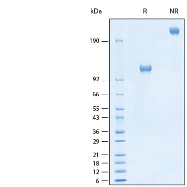 2 μg/lane of Recombinant Human ALCAM/CD166 Fc Chimera Avi-tag Protein (Catalog # AVI7187) was resolved with SDS-PAGE under reducing (R) and non-reducing (NR) conditions and visualized by Coomassie® Blue staining, showing bands at 100-120 kDa and 200-240 kDa, respectively.