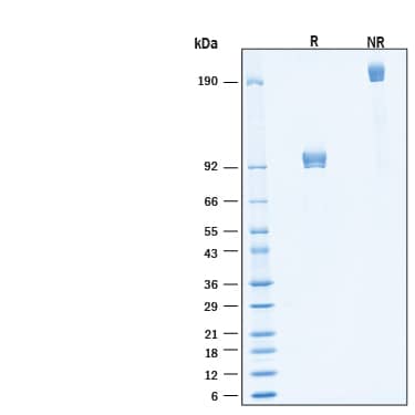2 μg/lane of Biotinylated Recombinant Human MuSK Fc Chimera Avi-tag Protein (Catalog # AVI9810) was resolved with SDS-PAGE under reducing (R) and non-reducing (NR) conditions and visualized by Coomassie® Blue staining, showing bands at 87-102 kDa and 170-200 kDa, respectively.