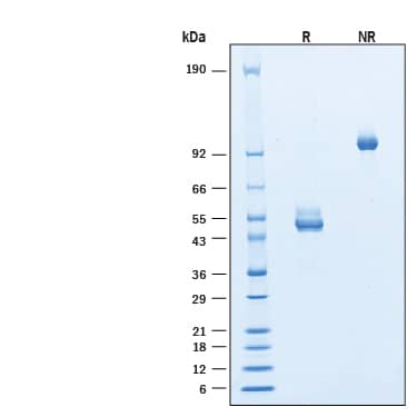 2 μg/lane of Biotinylated Recombinant Human CD3 epsilon Fc Chimera Avi-tag Protein (Catalog # AVI9850) was resolved with SDS-PAGE under reducing (R) and non-reducing (NR) conditions and visualized by Coomassie® Blue staining, showing bands at 45-60 kDa and 90-120 kDa, respectively.