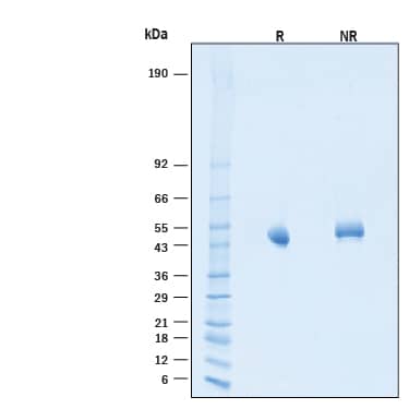 2 μg/lane of Biotinylated Recombinant Human SIRP gamma /CD172g His-tag Avi-tag Protein (Catalog # AVI9999) was resolved with SDS-PAGE under reducing (R) and non-reducing (NR) conditions and visualized by Coomassie® Blue staining, showing bands at 42-49 kDa, under reducing conditions.