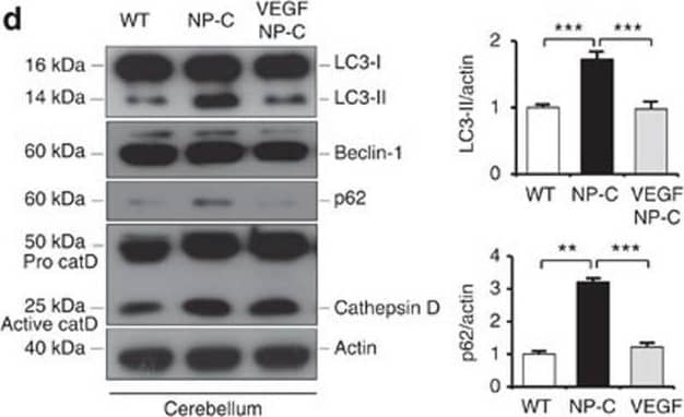 VEGF replenishment reverses defective autophagy in NP–C mice.(a) Western blot analysis of LC3, beclin-1, p62 and cathepsin D in primary cultured PNs derived from WT, NP–C and VEGF/NP–C mice (WT, n=5; NP–C, n=6; and VEGF/NP–C, n=6). (b) Immunocytochemistry of LC3 in WT, NP–C and VEGF/NP–C PNs (n=6 per group; scale bar, 20 μm). (c) Cathepsin D activity in primary cultured PNs (WT, n=5; NP–C, n=6; and VEGF/NP–C, n=6). (d) Western blot analysis of LC3, beclin-1, p62 and cathepsin D in the cerebellums of 6-week-old WT, NP–C and VEGF/NP–C mice (WT, n=6; NP–C, n=7; and VEGF/NP–C, n=7). (e) Cathepsin D activity in the cerebellums of WT, NP–C and VEGF/NP–C mice (WT, n=5; NP–C, n=6; and VEGF/NP–C, n=6). (f) EM images and quantification data of the cerebellum (n=5 per group; low-magnification scale bar, 1 μm; high-magnification scale bar, 200 nm). Arrow indicates autophagic vacuole. (g) Western blot analysis of Rab5 and Rab7 levels in the cerebellum (n=6 per group). (h) Cerebellar sections were immunostained with anti-active caspase-3 and the number of active caspase-3-positive cells in PCL was quantified (n=5 per group; scale bar, 50 μm). a–g, one-way analysis of variance, Tukey’s post hoc test. h, Student’s t-test. *P<0.05, **P<0.01, ***P<0.005. All error bars indicate s.e.m. Image collected and cropped by CiteAb from the following open publication (//pubmed.ncbi.nlm.nih.gov/25417698), licensed under a CC-BY license. Not internally tested by R&D Systems.