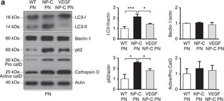 VEGF replenishment reverses defective autophagy in NP–C mice.(a) Western blot analysis of LC3, beclin-1, p62 and cathepsin D in primary cultured PNs derived from WT, NP–C and VEGF/NP–C mice (WT, n=5; NP–C, n=6; and VEGF/NP–C, n=6). (b) Immunocytochemistry of LC3 in WT, NP–C and VEGF/NP–C PNs (n=6 per group; scale bar, 20 μm). (c) Cathepsin D activity in primary cultured PNs (WT, n=5; NP–C, n=6; and VEGF/NP–C, n=6). (d) Western blot analysis of LC3, beclin-1, p62 and cathepsin D in the cerebellums of 6-week-old WT, NP–C and VEGF/NP–C mice (WT, n=6; NP–C, n=7; and VEGF/NP–C, n=7). (e) Cathepsin D activity in the cerebellums of WT, NP–C and VEGF/NP–C mice (WT, n=5; NP–C, n=6; and VEGF/NP–C, n=6). (f) EM images and quantification data of the cerebellum (n=5 per group; low-magnification scale bar, 1 μm; high-magnification scale bar, 200 nm). Arrow indicates autophagic vacuole. (g) Western blot analysis of Rab5 and Rab7 levels in the cerebellum (n=6 per group). (h) Cerebellar sections were immunostained with anti-active caspase-3 and the number of active caspase-3-positive cells in PCL was quantified (n=5 per group; scale bar, 50 μm). a–g, one-way analysis of variance, Tukey’s post hoc test. h, Student’s t-test. *P<0.05, **P<0.01, ***P<0.005. All error bars indicate s.e.m. Image collected and cropped by CiteAb from the following open publication (//pubmed.ncbi.nlm.nih.gov/25417698), licensed under a CC-BY license. Not internally tested by R&D Systems.