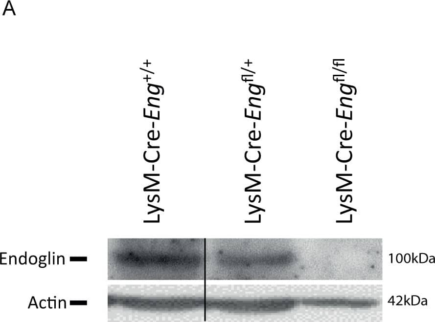 Monocyte specific knock-out of endoglin does not recapitulate the Eng+/- phenotype.(A) Western blot analysis of endoglin protein expression in LysM-Cre-Eng+/+, LysM-Cre-Engfl/+ and LysM-Cre-Engfl/fl cultured macrophages. A representative experiment is shown. (B) Quantification of the Western blots for endoglin protein in LysM-Cre-Eng+/+, LysM-Cre-Engfl/+ and LysM-Cre-Engfl/fl cultured macrophages in two independent experiments(macrophage cultures from 3 individual mice of each genotype were pooled per western blot). (C) Kaplan-Meier survival curve of wild type (WT), LysM-Cre-Engfl/+ and LysM-Cre-Engfl/fl mice 28 days post-MI (n = 6–10). (D) Cardiac function in percentage ejection fraction (%EF) 14 days post-MI. Cardiac function was measured by ultrasound in long axis view (n = 5–9). Data are shown as mean ± SEM, *P<0.05. Image collected and cropped by CiteAb from the following publication (//pubmed.ncbi.nlm.nih.gov/29253907), licensed under a CC-BY license. Not internally tested by R&D Systems.