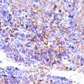 B7‑2/CD86 was detected in immersion fixed paraffin-embedded sections of Rat Spleen using Goat Anti-Rat B7‑2/CD86 Biotinylated Antigen Affinity-purified Polyclonal Antibody (Catalog # BAF1340) at 10 &micro;g/mL for 1 hour at room temperature followed by incubation with the Anti-Goat IgG VisUCyte&trade; HRP Polymer Antibody (Catalog # VC004). Before incubation with the primary antibody, tissue was subjected to heat-induced epitope retrieval using VisUCyte Antigen Retrieval Reagent-Basic (Catalog # VCTS021). Tissue was stained using DAB (brown) and counterstained with hematoxylin (blue). Specific staining was localized to cell surface and cytoplasm in splenocytes. View our protocol for IHC Staining with VisUCyte HRP Polymer Detection Reagents.
