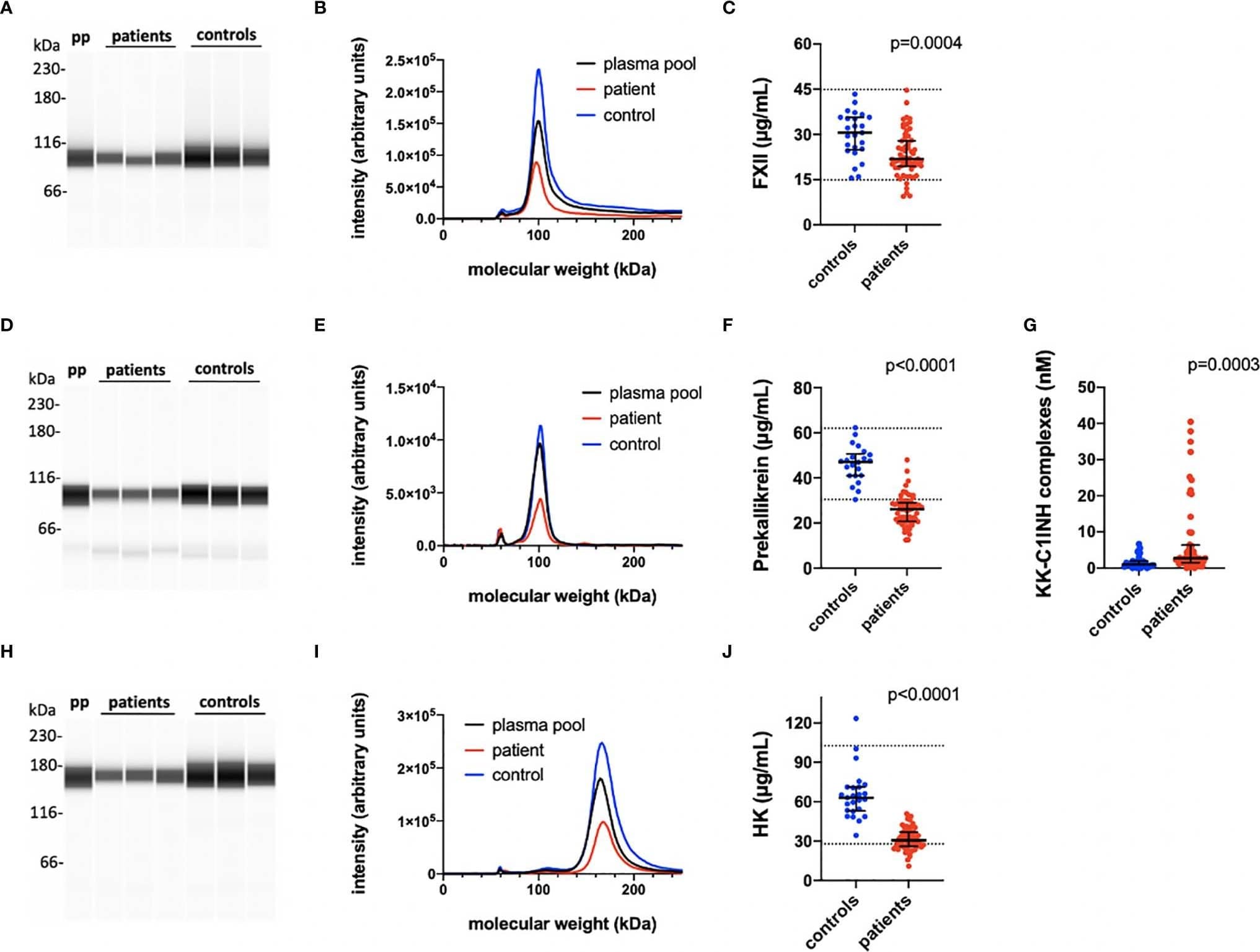 Quantification of the kallikrein/kinin proteins FXII, prekallikrein and high molecular weight kininogen (HK). The kallikrein/kinin system was activated as reflected in high consumption of FXII, prekallikrein, and HK. EDTA plasma from COVID-19 patients and controls were analyzed by capillary electrophoresis under reduced SDS-PAGE-like conditions and the specific kallikrein/kinin proteins detected by specific antibodies against FXII, prekallikrein, and HK, respectively (A, D, H). The area under the curves of the scan of the chemiluminescence intensities plotted in the panels (B, E, I) were interpreted to their specific concentration by comparing the value for each peak with a standard curve specific for each protein (C, F, J). The concentration of KK-C1INH complexes were analyzed by sandwich ELISA (panel G). Representative patients and controls are shown in panels (A, B, D, E, H, I). The Mann-Whitney U test was used to calculate differences between the groups. For more details see Materials and Methods. pp, plasma pool; KK, kallikrein; C1INH, C1inhibitor; HK, high molecular weight kininogen. Image collected and cropped by CiteAb from the following publication (//pubmed.ncbi.nlm.nih.gov/33692801), licensed under a CC-BY license. Not internally tested by R&D Systems.