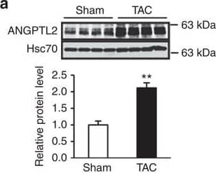 ANGPTL2 expression is increased in stressed cardiomyocytes.(a–c) Representative western blot and quantitation of ANGPTL2 protein in hearts from WT mice 6 weeks after TAC or sham surgery (n=5 per group) (a) and 2 weeks after Angiotensin II (Ang II) or vehicle treatment (n=8 per group) (b). Analysis of ANGPTL2 and GFP protein from GFP+ cardiomyocytes and GFP− non-cardiomyocytes from Myh6-EGFP Tg mice (n=3 per group) (c). Hsc70 served as a loading control. Normalized values from controls (a,b) or GFP+ cardiomyocytes (c) were set to 1. (d,e) Quantitative RT-PCR analysis of Angptl2 expression in GFP+ and GFP– cells 6 weeks after TAC or sham surgery (d) and 2 weeks after Ang II or vehicle treatment (e) (n=3 per group). Values for respective controls were set to 1. (f,g) Relative ANGPTL2 transcript (f) and protein (g) levels in NRCMs assessed 6 or 12 h after Ang II (left in f,g) or Iso (right in f) treatment, with or without cyclosporine A (CsA) treatment. Values before treatment were set to 1. n=4–8 per group. (h) Relative ANGPTL2 transcript levels in NRCMs 8 h after Ang II treatment, with or without xestospongin C (Xes C) treatment. Values from control NRCMs were set to 1. n=8 per group. (i) Relative Angptl2 transcript levels in NRCMs overexpressing constitutively active NFAT (CA-NFAT). Values from control NRCMs were set to 1. n=3 per group. Data are means±s.e.m. Statistical significance was determined by Student's t test (a–e and i) or one-way ANOVA (f–h). *P<0.05, **P<0.01, †P<0.001 between groups. Image collected and cropped by CiteAb from the following publication (//pubmed.ncbi.nlm.nih.gov/27677409), licensed under a CC-BY license. Not internally tested by R&D Systems.