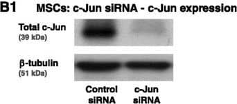 Induction of CCL2 and CLXL8 in TNF alpha -stimulated MSCs is not mediated via the AP-1 pathway. (A) Human BM-derived MSCs were stimulated by TNF-alpha  (50 ng/ml) for 5 and 10 minutes. Control cells were treated by the vehicle of TNF-alpha . c-Jun levels and phosphorylation were determined by western blot (WB) analyses. Glyceraldehyde 3-phosphate dehydrogenase (GAPDH) was used as loading control. (B) Human BM-derived MSCs were transiently transfected by small interfering RNA (siRNA) to c-Jun or by control siRNA. (B1) c-Jun expression was determined by WB analyses.  beta -Tubulin was used as loading control. (B2) Following siRNA transfection, the cells were stimulated by TNF-alpha  (25 ng/ml; in this part of the study we used a suboptimal concentration of TNF-alpha  in order to facilitate detection of inhibitory effects) for 24 hours. Expression levels of CCL2 and CXCL8 in the supernatants of the cells were determined by ELISA, in the linear range of absorbance. #siRNA to c-Jun has yielded minor increases or reductions in CCL2 and CXCL8 secretion in different experiments (see Results and discussion), and thus overall there was no significant effect on CCL2 and CXCL8 secretion. In all panels, the findings are representatives of n = 3 independent experiments that have shown similar results. Image collected and cropped by CiteAb from the following publication (//stemcellres.biomedcentral.com/articles/10.1186/s13287-015-0080-7), licensed under a CC-BY license. Not internally tested by R&D Systems.